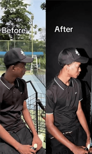 Before/After Videos